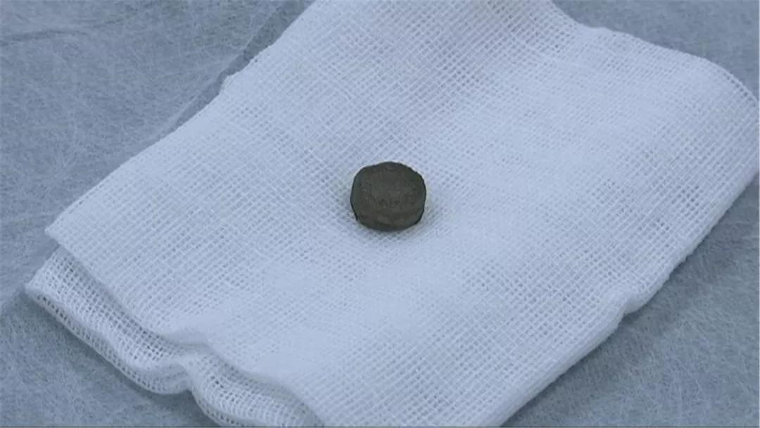 4岁男孩吃了它，体内充血水肿糜烂！快把家中这个东*藏西**好