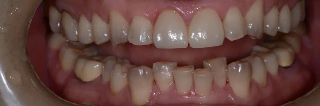 口腔牙医感言,牙医从业感悟