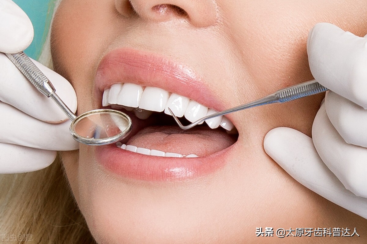 洗牙可以去除氟斑牙吗,洗牙可以改善牙肉红肿吗