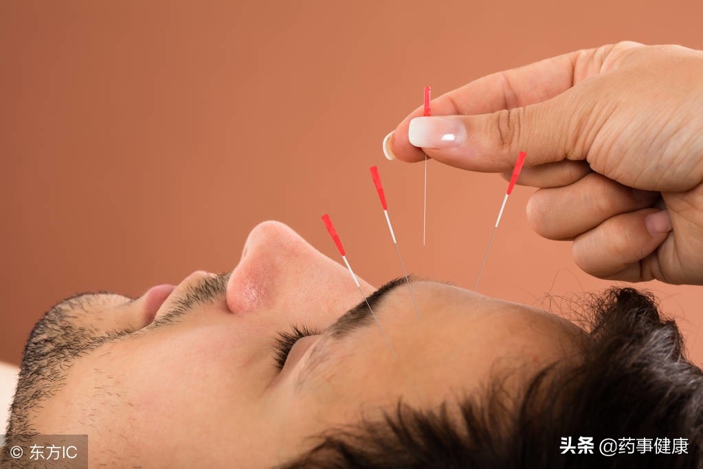 脱发越来越成为中青年人的烦心事，究竟如何摆脱秃顶的烦恼？