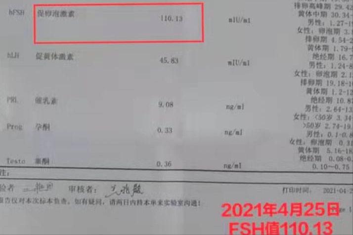 fsh值113卵巢早衰能治好吗,fsh超过10就是卵巢早衰吗