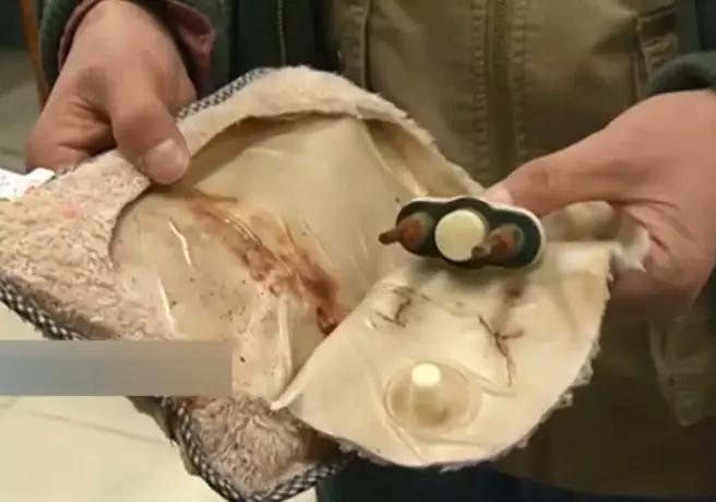 女子将热水袋放在腹部，睡梦中突然爆炸！