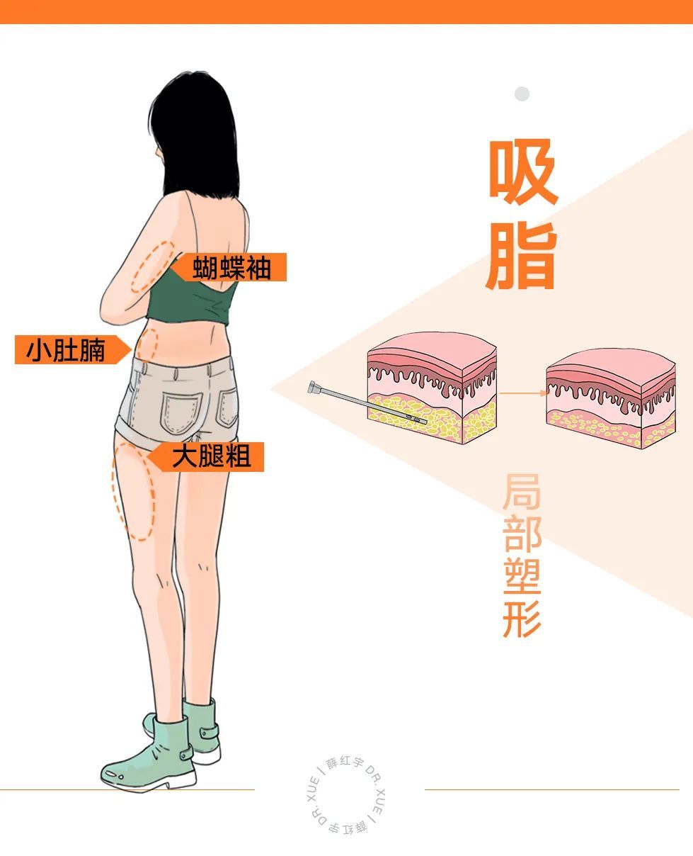 吸脂须知,吸脂必知