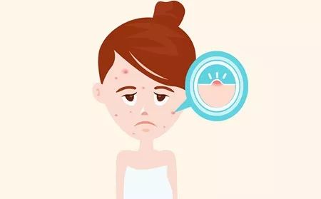 长痘期间如何护肤,长痘后该怎样护肤听听专家怎么说