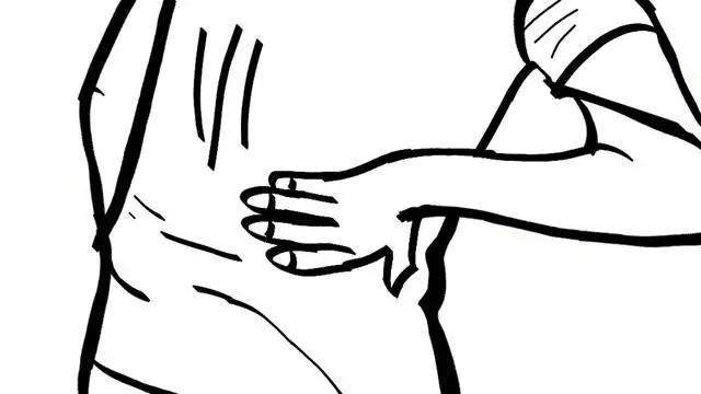 39岁男子深夜血尿突然肾衰竭,30岁男性肉眼可见血尿原因