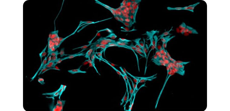 我们人体排毒系统有多强,细胞自噬对身体不好