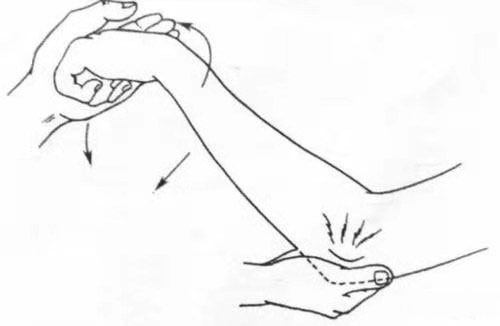 网球肘肌肉劳损,网球肘造成胳膊弯了最佳治疗方法