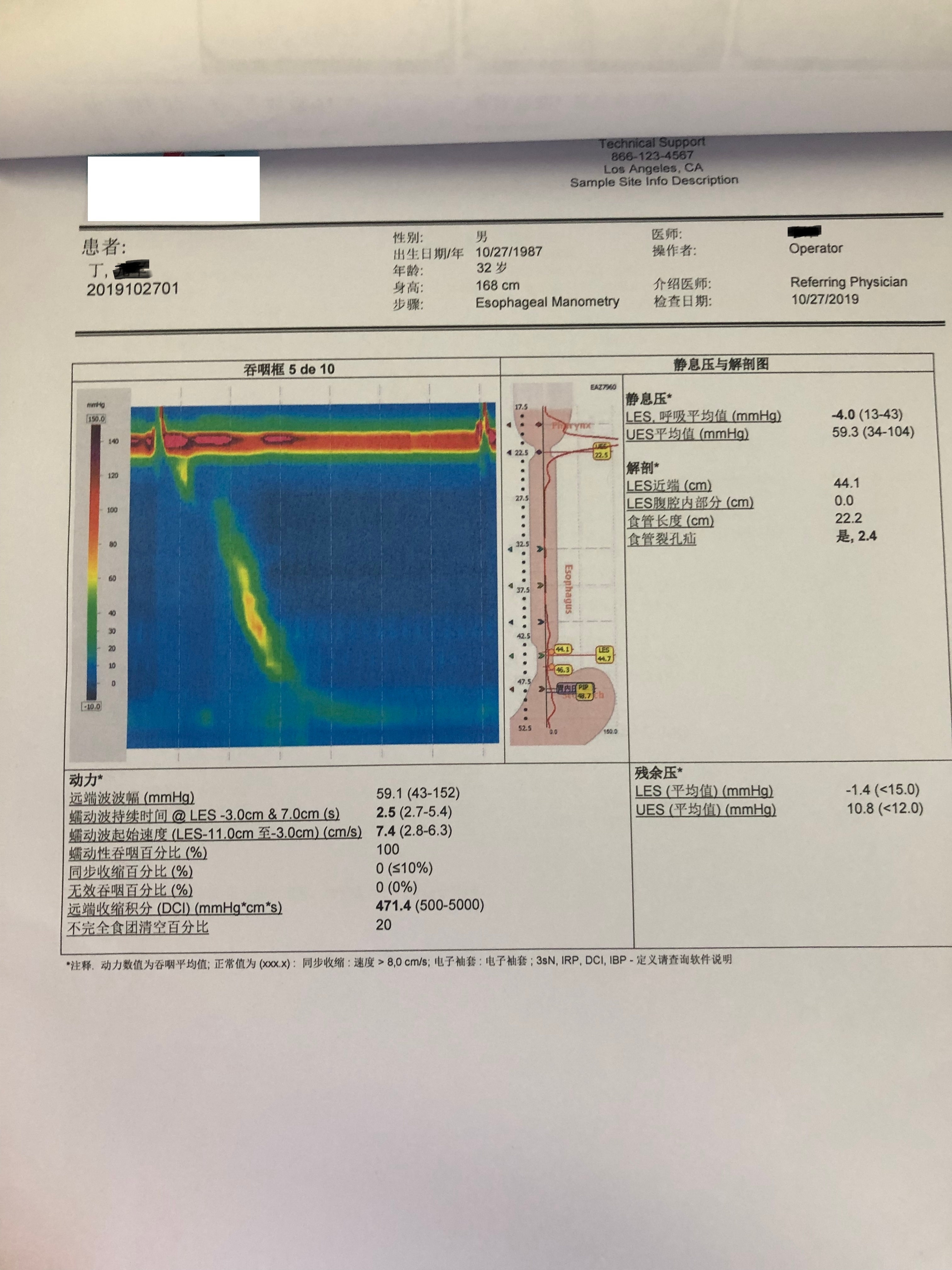 胆囊切除后饭后吐酸水,胆囊摘除后胃胀怎么办