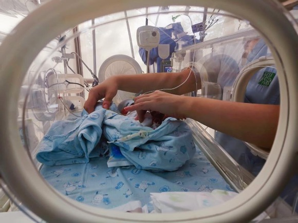 早产儿随访有必要吗,早产儿如何教育