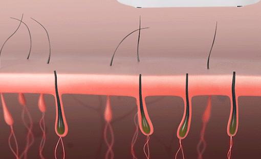 现在什么美容项目最赚钱最火,美容最挣钱的仪器