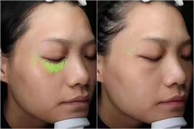 伊肤泉小白瓶怎么那么便宜,上市首月狂卖12000台