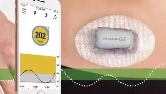 糖尿病餐前打胰岛素作用,糖尿病人饭前针不打行不行