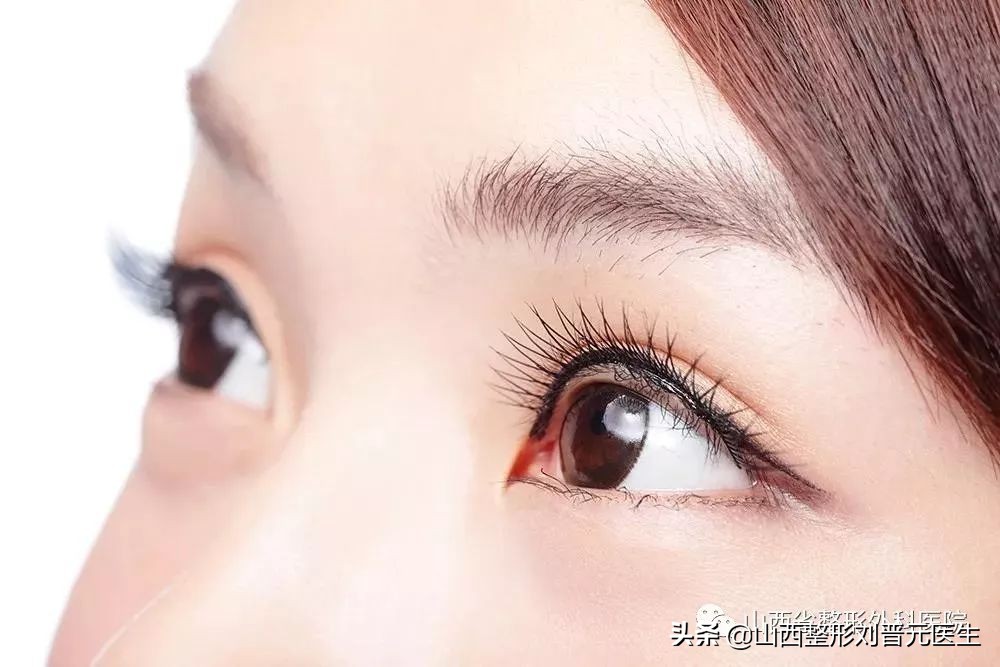 5000元做双眼皮惨不忍睹,哪种双眼皮性价比高