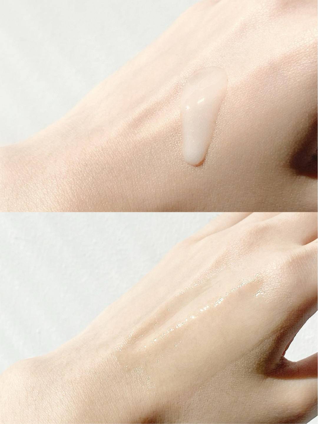 每天美白皮肤还是越来越黑,一直在美白却越来越黑的原因