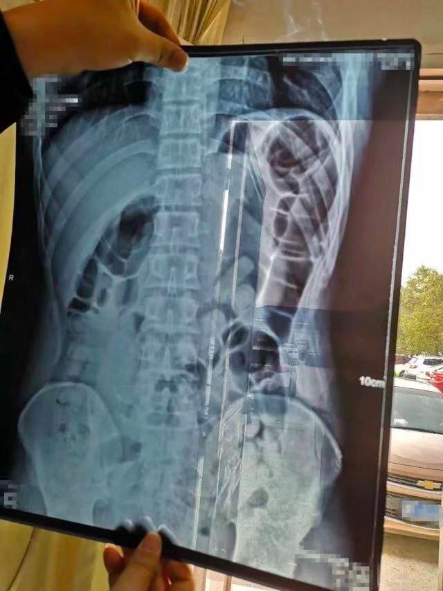 英国首相约翰逊目睹囚犯体内藏毒扫描照，竟被吓得连连*退倒**