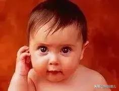 凸嘴的坏习惯,龅牙导致的嘴凸应该怎么改善