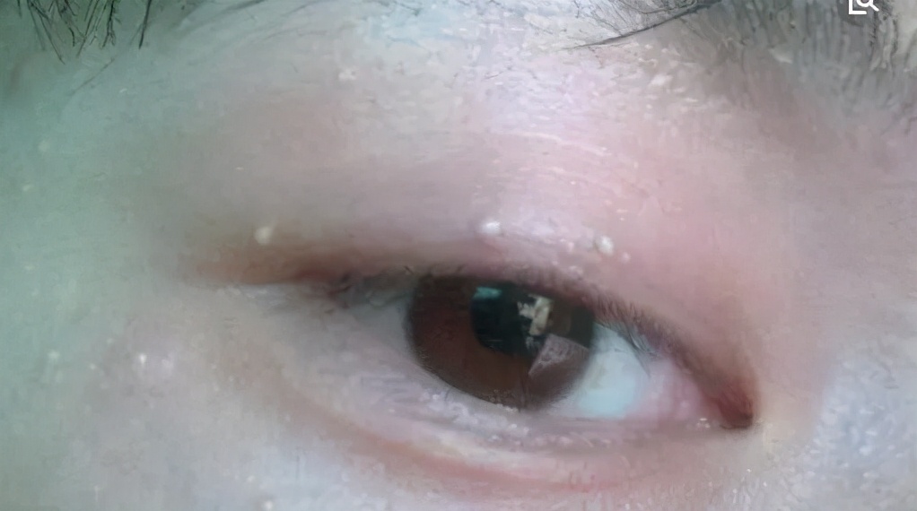 小孩剪睫毛能让睫毛变长吗,怎样让睫毛变长变密简单方法儿童