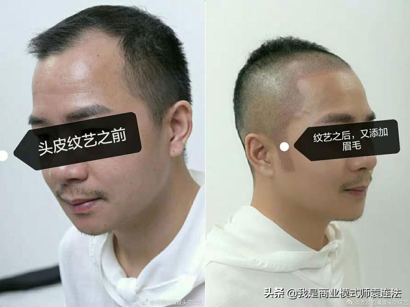 纹发成功案例,纹发招商视频