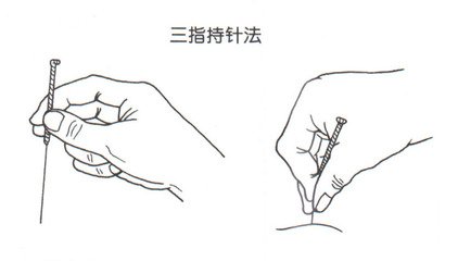 巧取臂臑穴,臂臑穴能瘦手臂吗