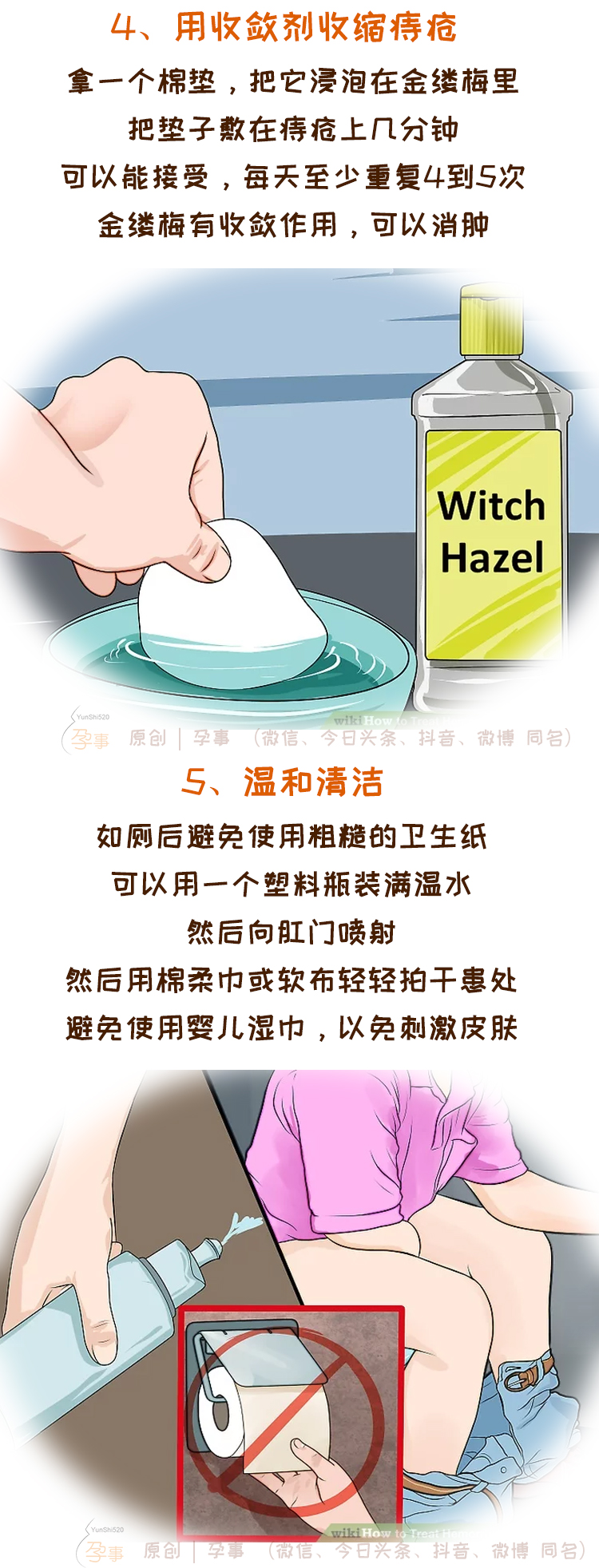 怀孕分娩后痔疮大爆发，三个步骤正确护理缓解疼痛