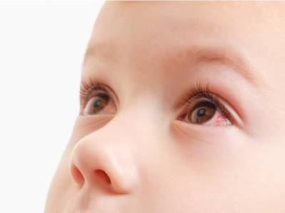 孩子总是揉眼睛用什么药,孩子总是揉眼睛眼疼怎么办