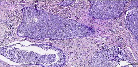 显微镜下的万花世界——走进病理学