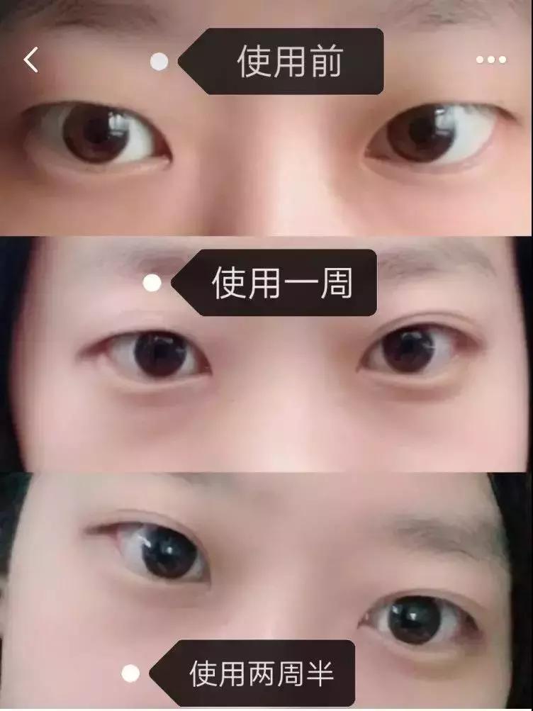 怎么挑选一款适合的眼霜,怎么选择一款适合自己的眼霜