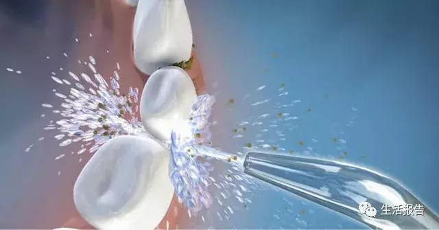 冲牙器水牙线实测,水牙线冲牙器品牌哪个好用