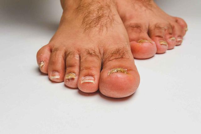 男人腿毛太多说明什么,男人腿毛多和少的区别