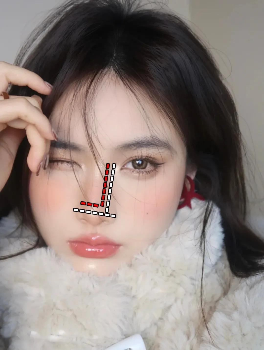 点痣就能变美,点痣整容大法