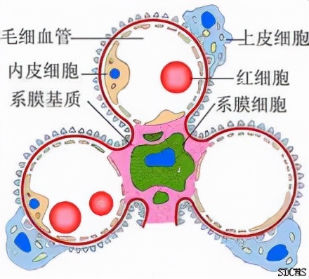 肾脏病为什么会浮肿,慢性肾水肿特效药
