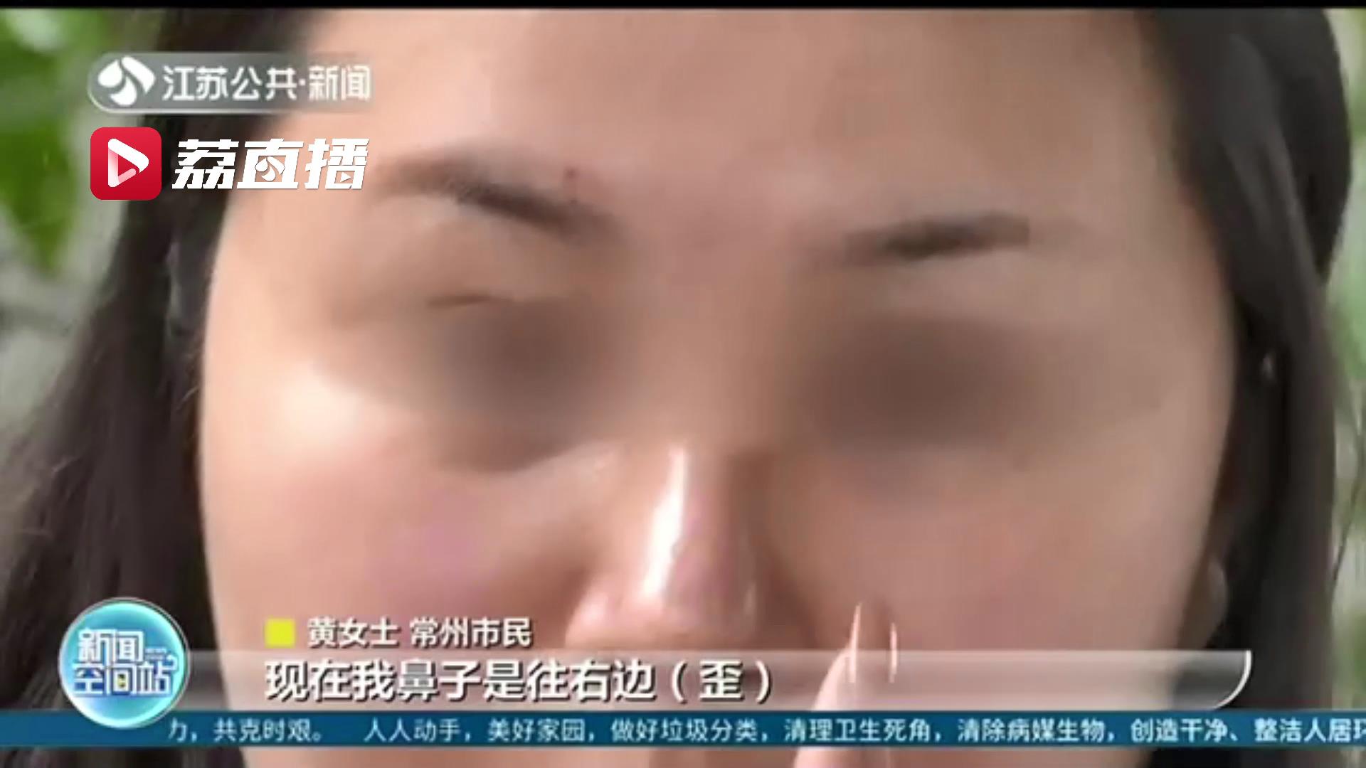 鼻整形后假体歪斜,整形歪鼻手术