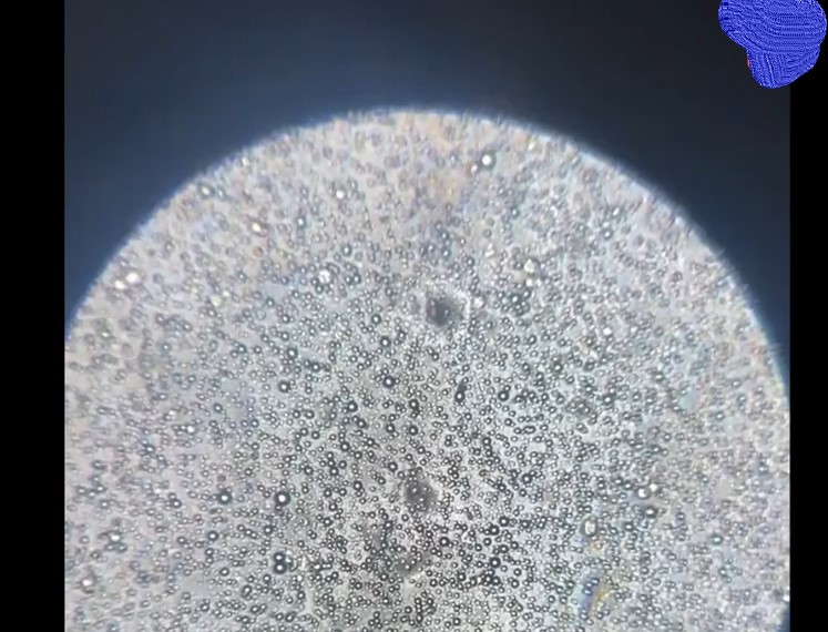 显微镜放大1000倍现原形,母乳在显微镜下被放大1000倍