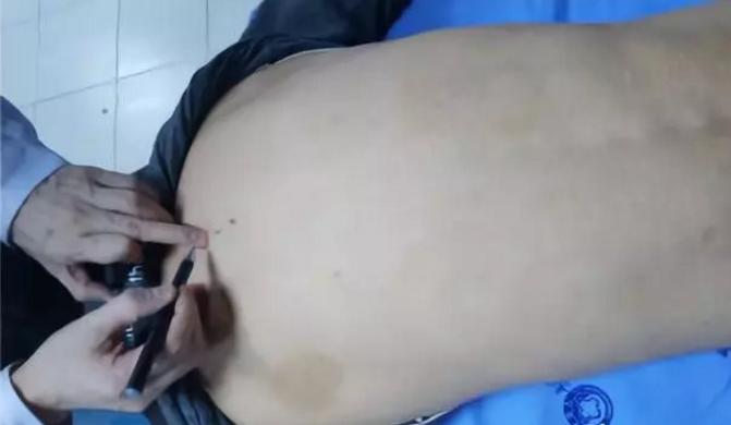 脊柱相关疾病治疗学,脊柱畸形看病经验分享