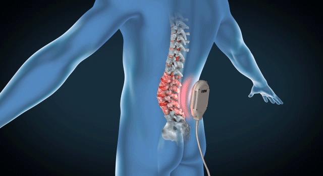 铁腰板治腰突有作用吗,铁腰板有什么用