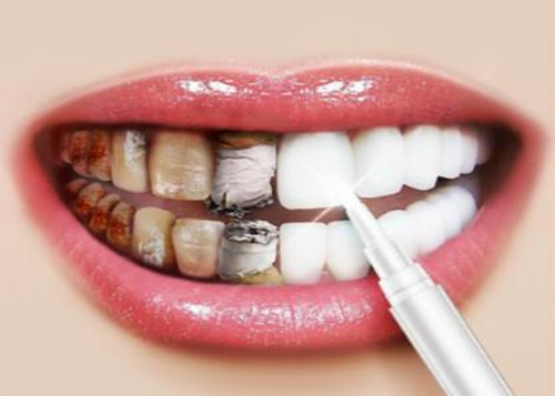 大连齿医生口腔科普5种常见行为习惯,让你牙龈越来越脆弱