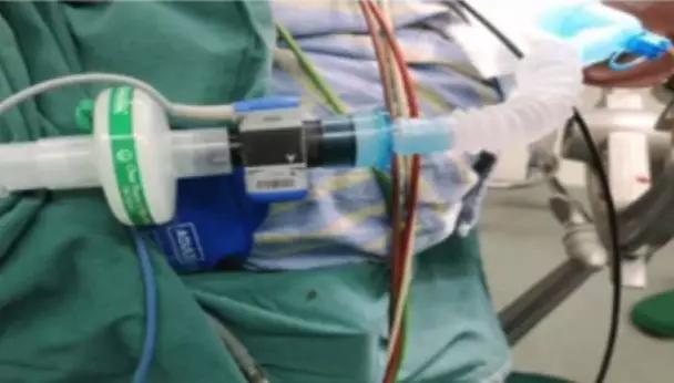 李娟教授：呼气末二氧化碳分压监测的临床应用