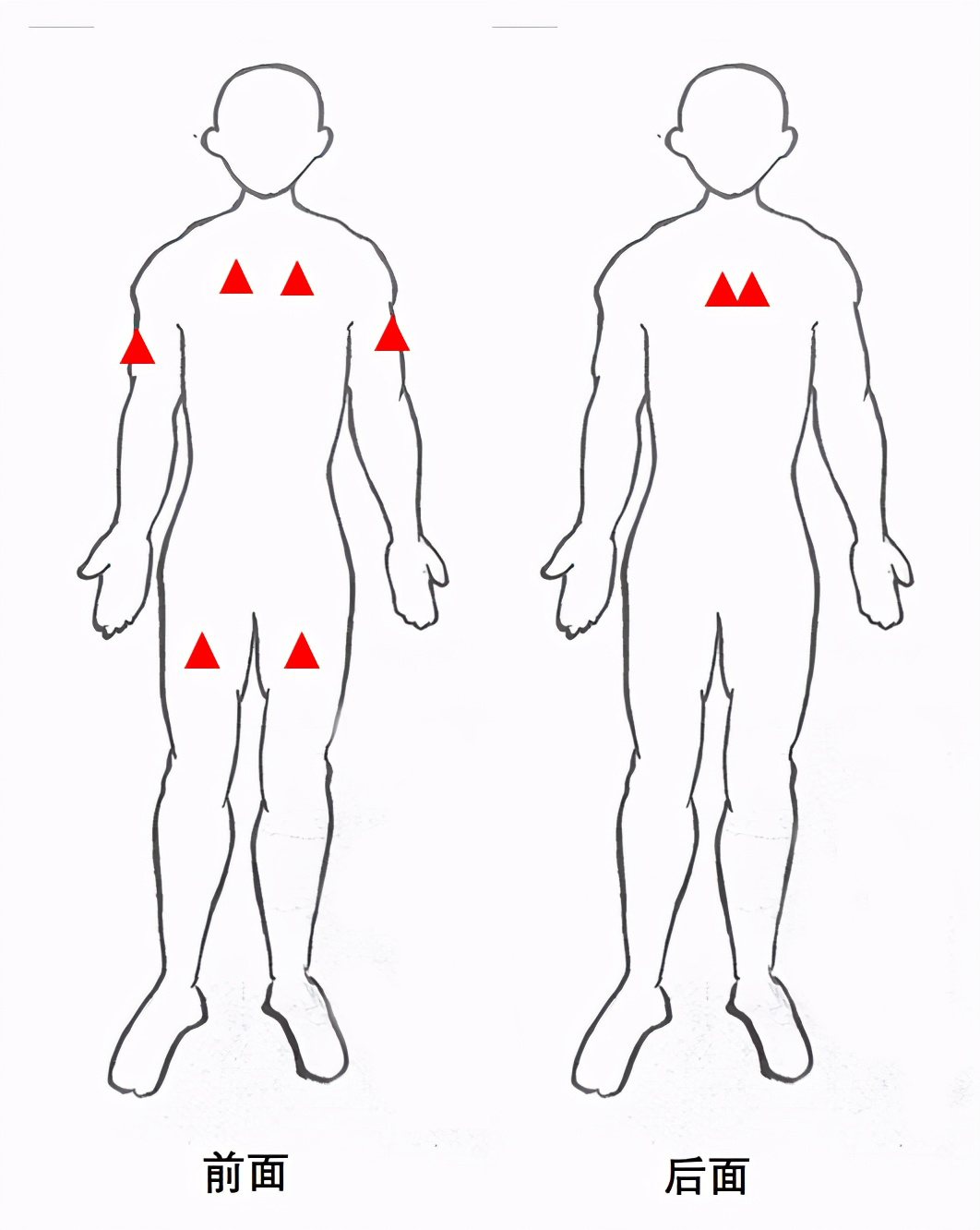 止痛药不管用会怎么样,止痛药没有效果