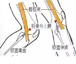 这个伤让他连续三年无缘马拉松！其实1/10的跑者都在被它折磨！