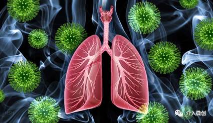 肺转移瘤消融能达到根治效果吗,肺转移瘤中医治疗