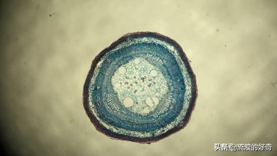 oppofindx3pro显微镜拍螨虫,oppofindx3显微镜可以看螨虫吗