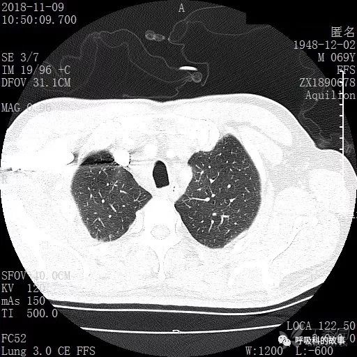 怎么应用统计学做调查,统计学方法可以解决的主要问题