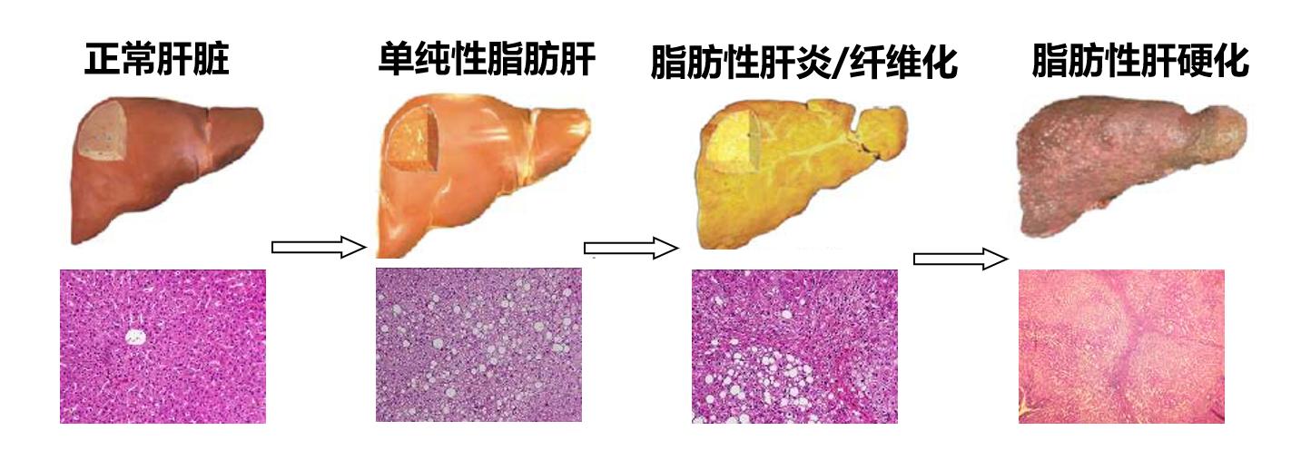 发现肝脏实性占位后做什么检查,肝脏阴影或占位有可能是哪些病