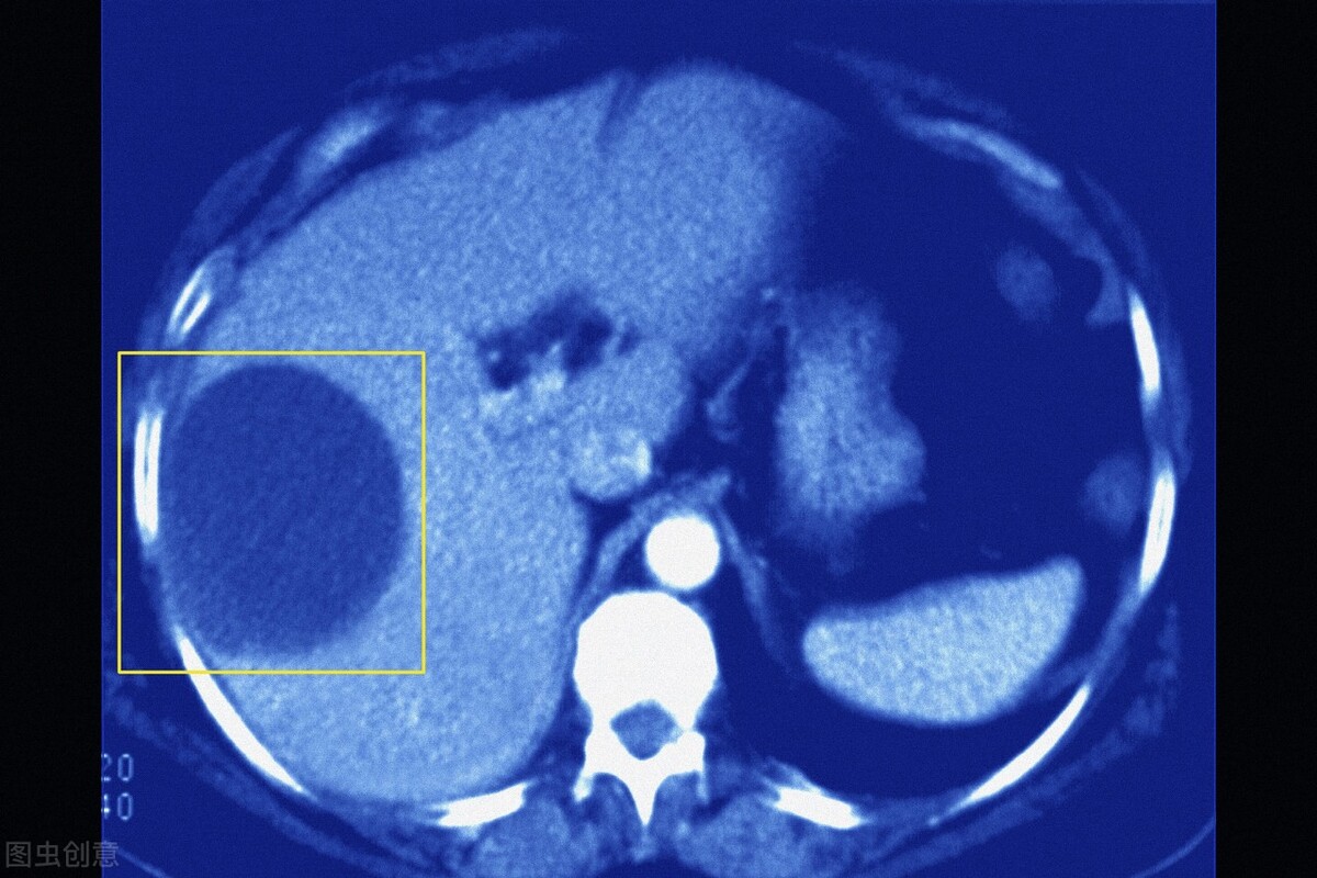 体检出这8种疾病不要再花冤枉钱,体检常见的哪些病不用担心