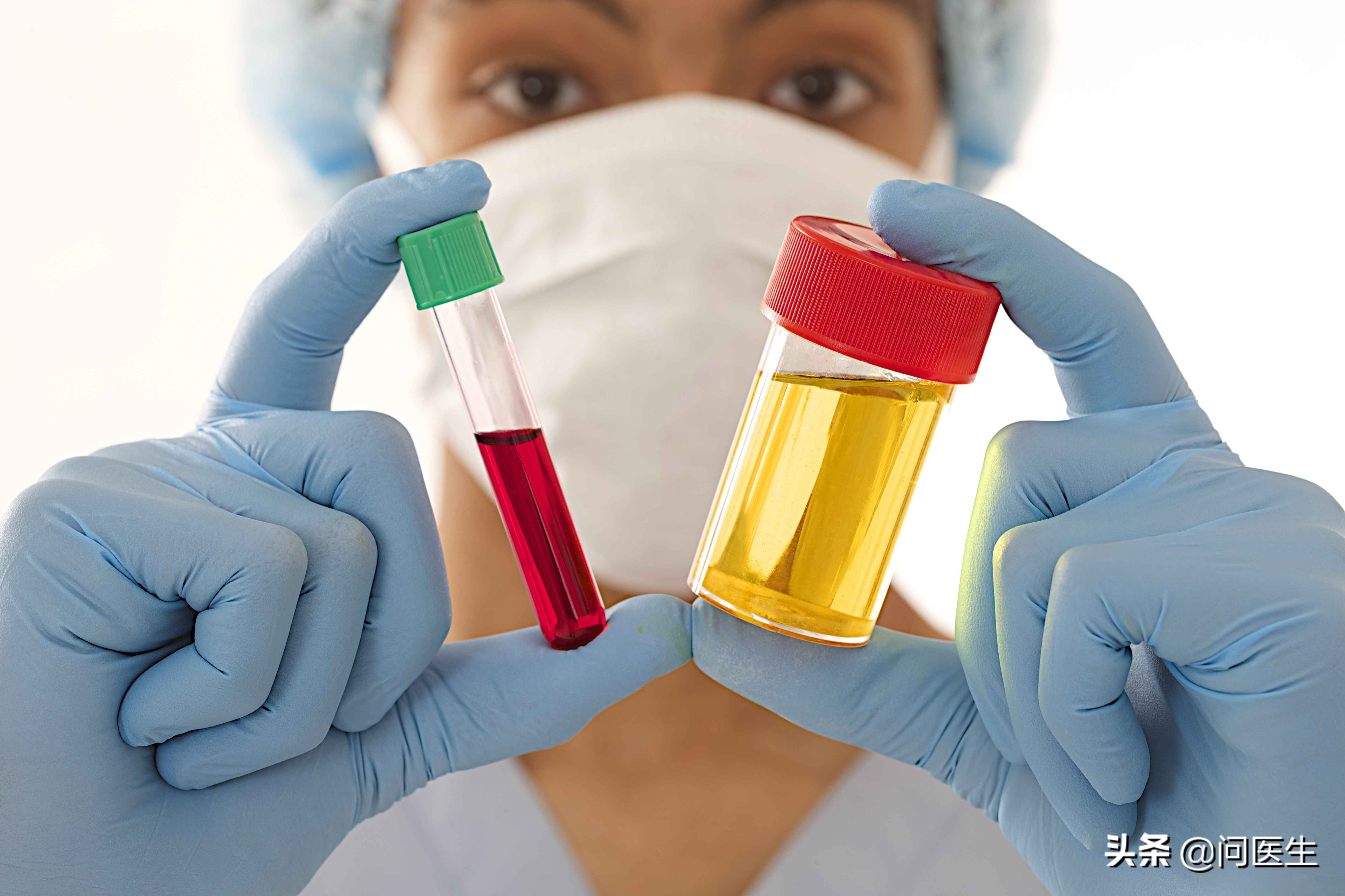 血脂胆固醇甘油三酯都高怎么办,血脂胆固醇甘油三酯高怎么调理