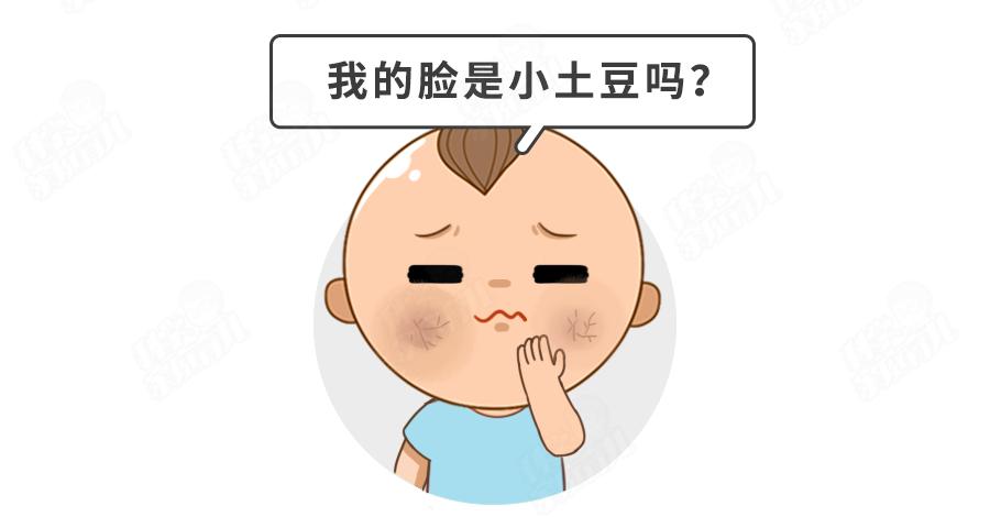 宝宝霜黑名单,曝光激素宝宝霜