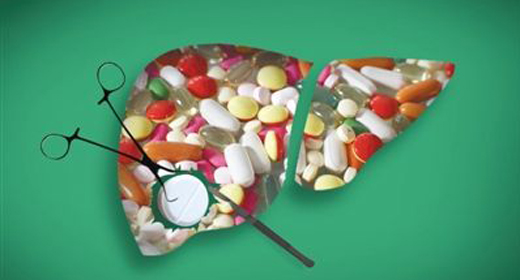 是药三分毒，吃药如何保护肝脏？