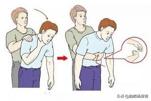 水果卡喉咙没怎么样可以不管吗,水果卡喉