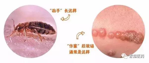 免疫力下降引起皮肤过敏吃什么药,眼睛周围皮肤过敏红肿痒用什么药