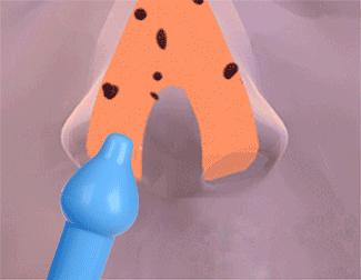 宝宝鼻塞流鼻涕太难受，这个缓解小方法，安全又管用